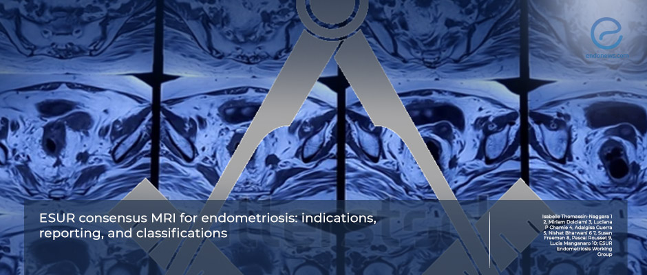 ESUR Experts Redefine MRI Standards in Endometriosis