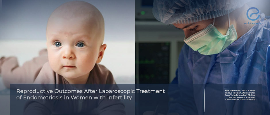 Laparoscopic Treatment and Pregnancy Outcomes in Endometriosis-Associated Infertility