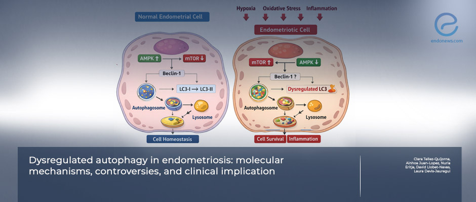 Autophagy dysregulation reshapes our understanding of endometriosis biology