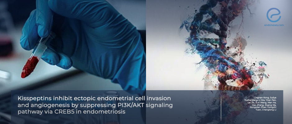 Molecular Insights Into KISS1 in Endometriosis