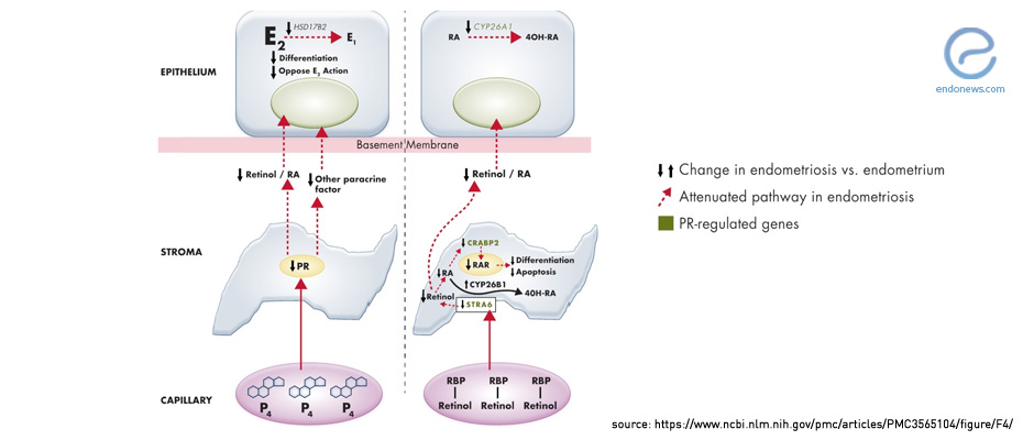 Deciphering the mechanisms of action of progesterone in breast cancer