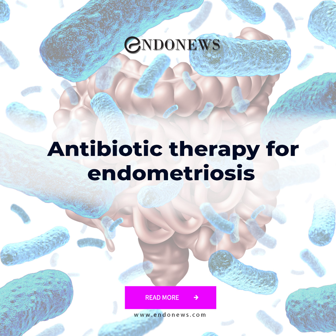 Antibiotic therapy for endometriosis EndoNews