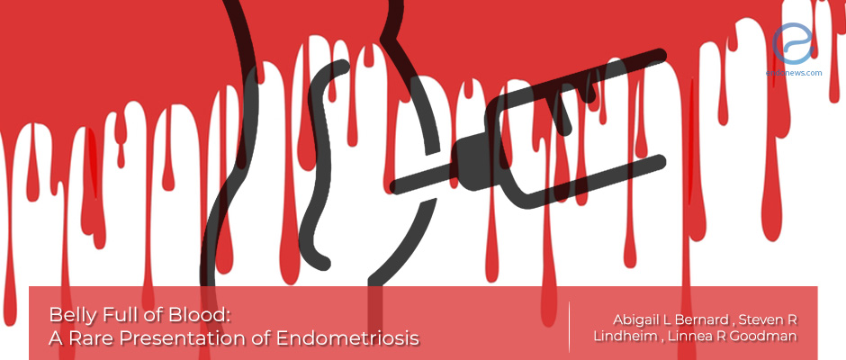 Hemorrhagic Ascites, Belly-Blood: The cause may be endometriosis