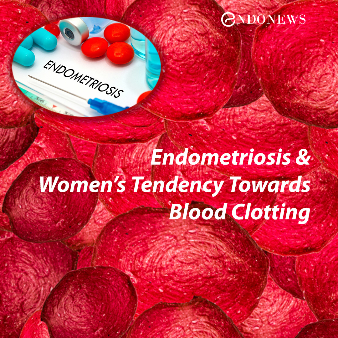 Menstrual Clots and How They Are Linked to Endometriosis