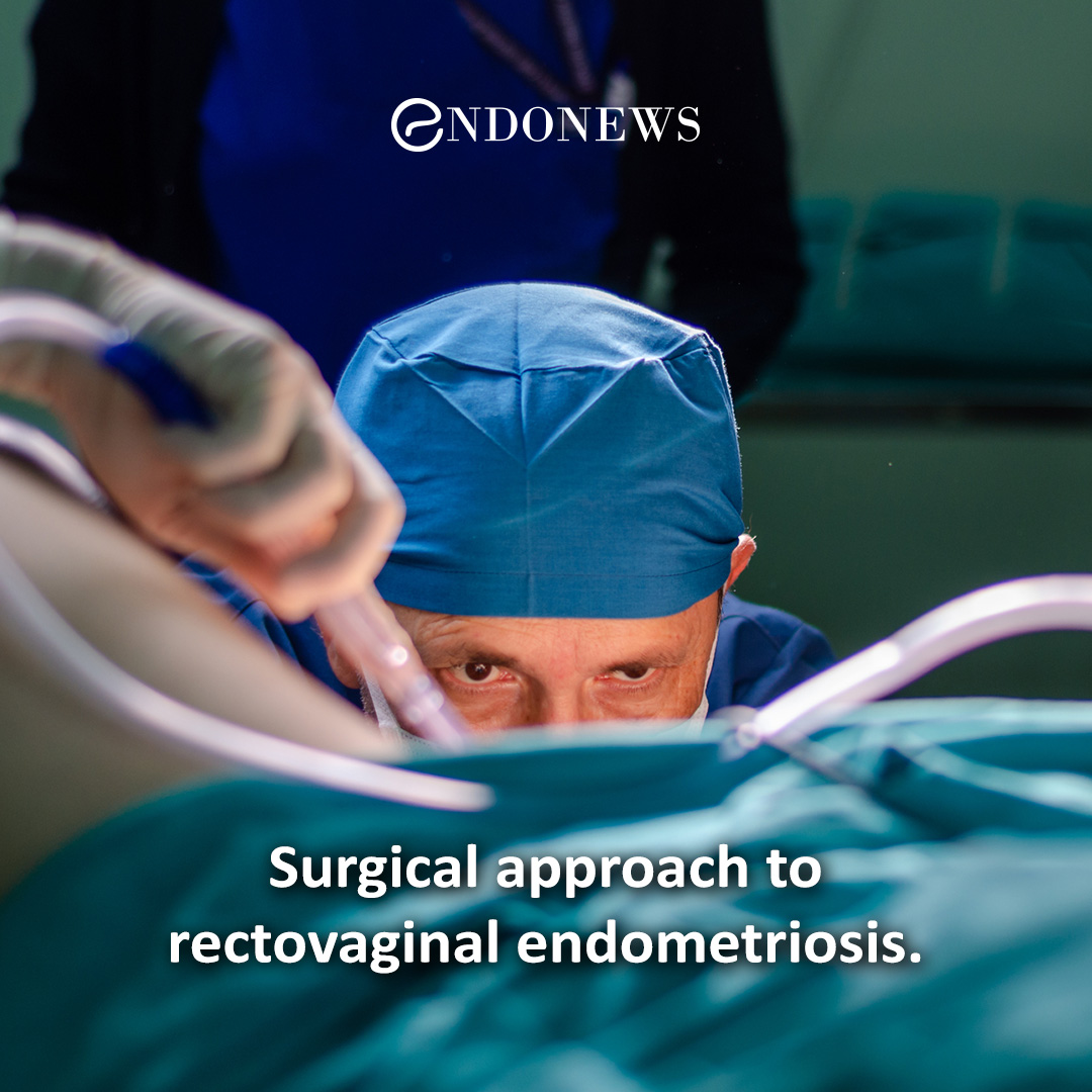 surgery for severe endometriosis