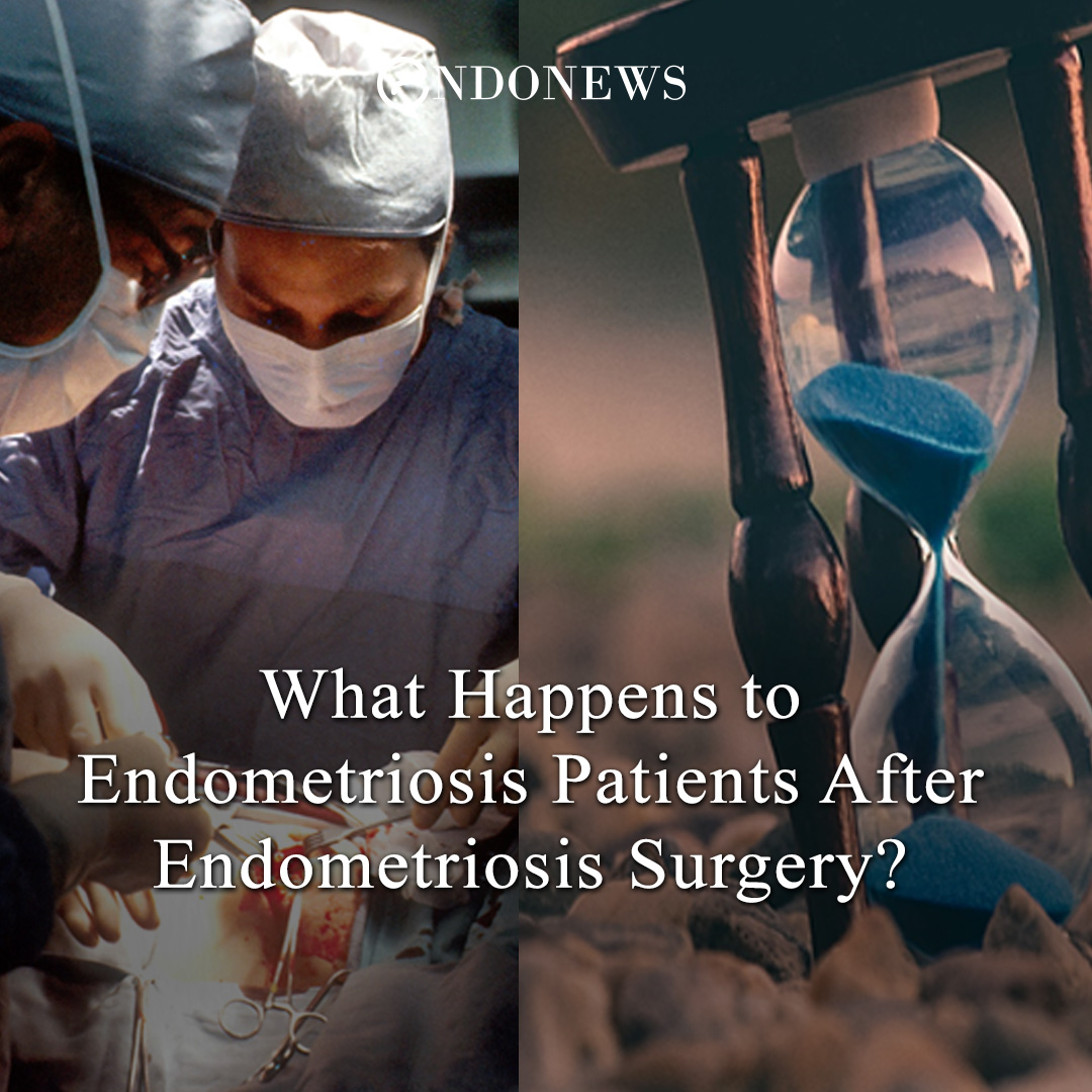 What Happens To Endometriosis Patients After Endometriosis Surgery Endonews 3329