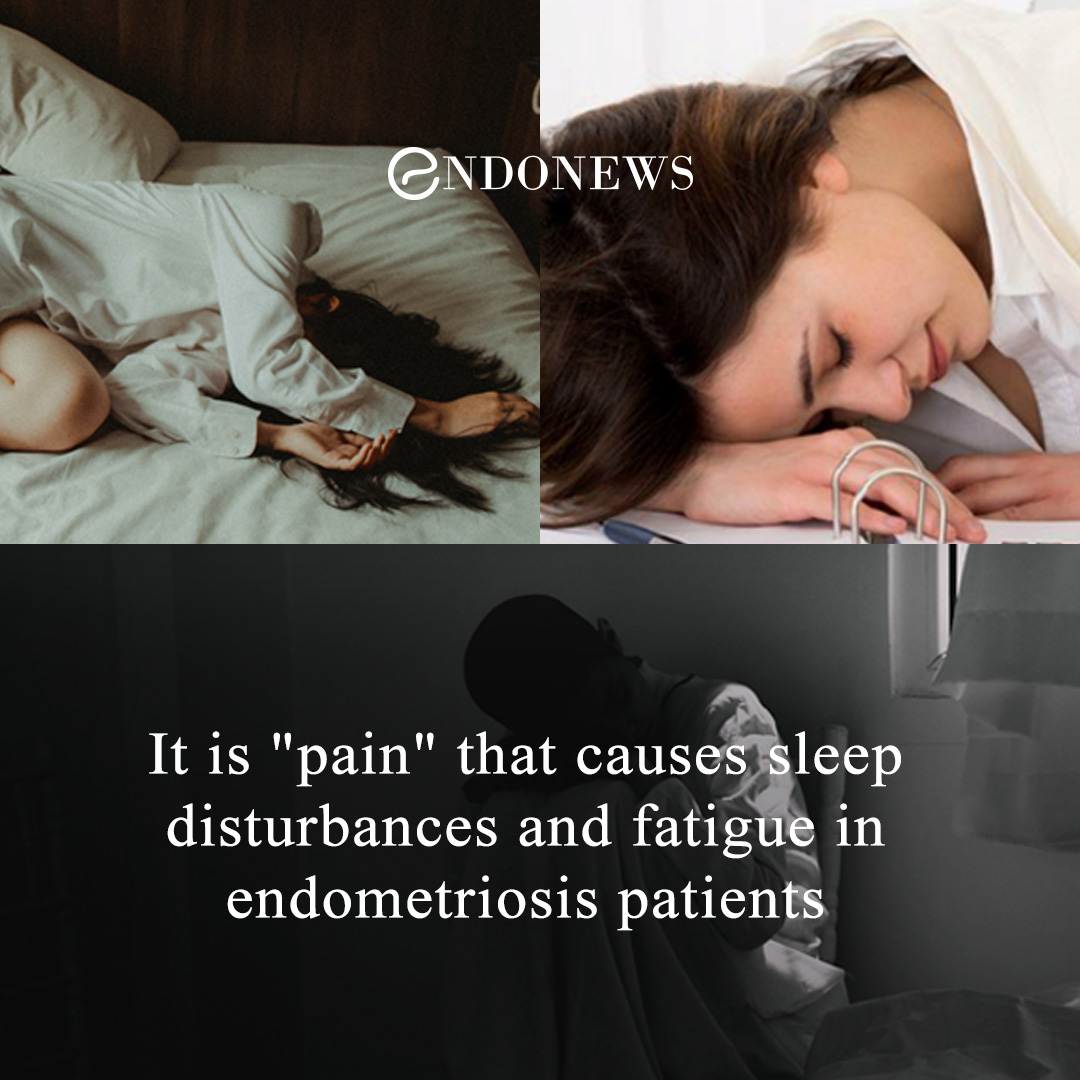 it-is-pain-that-causes-sleep-disturbances-and-fatigue-in