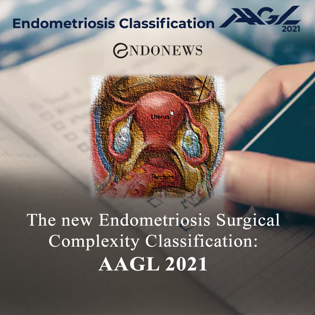 The New Endometriosis Surgical Complexity Classification Aagl 2021 Endonews 7305