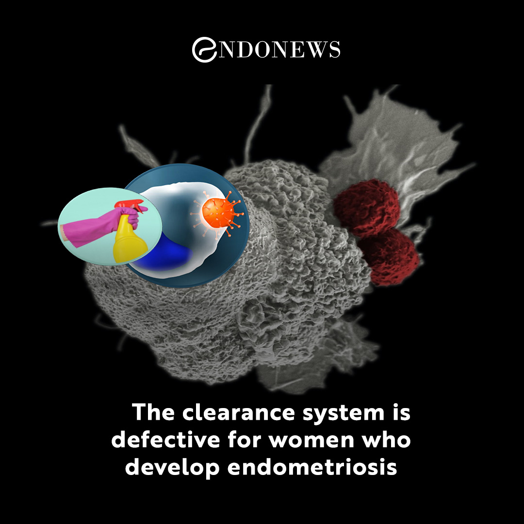 The Clearance System Is Defective For Women Who Develop Endometriosis EndoNews