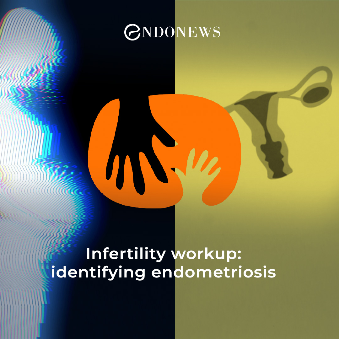 Endometriosis Associated Infertility How To Manage Endonews