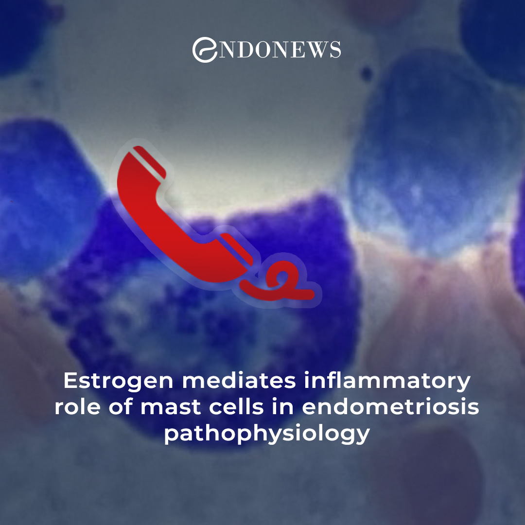 a-call-for-mast-cells-from-endometriotic-lesions-endonews