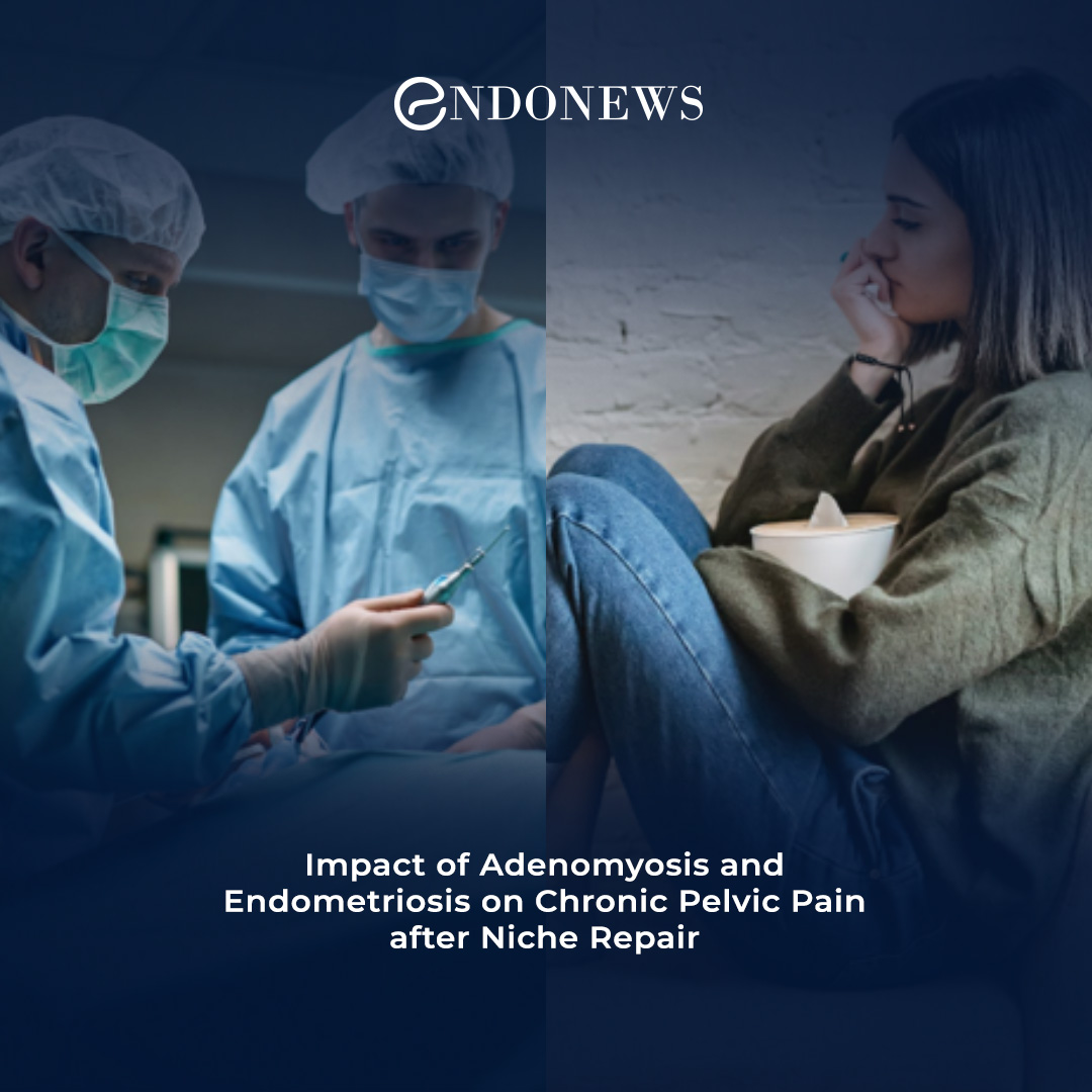 outcomes-of-chronic-pelvic-pain-after-niche-repair-endonews