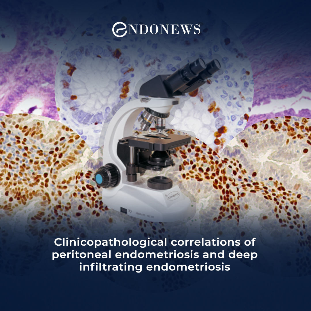 A pioneering study on clinicopathologic features of biopsies of ...