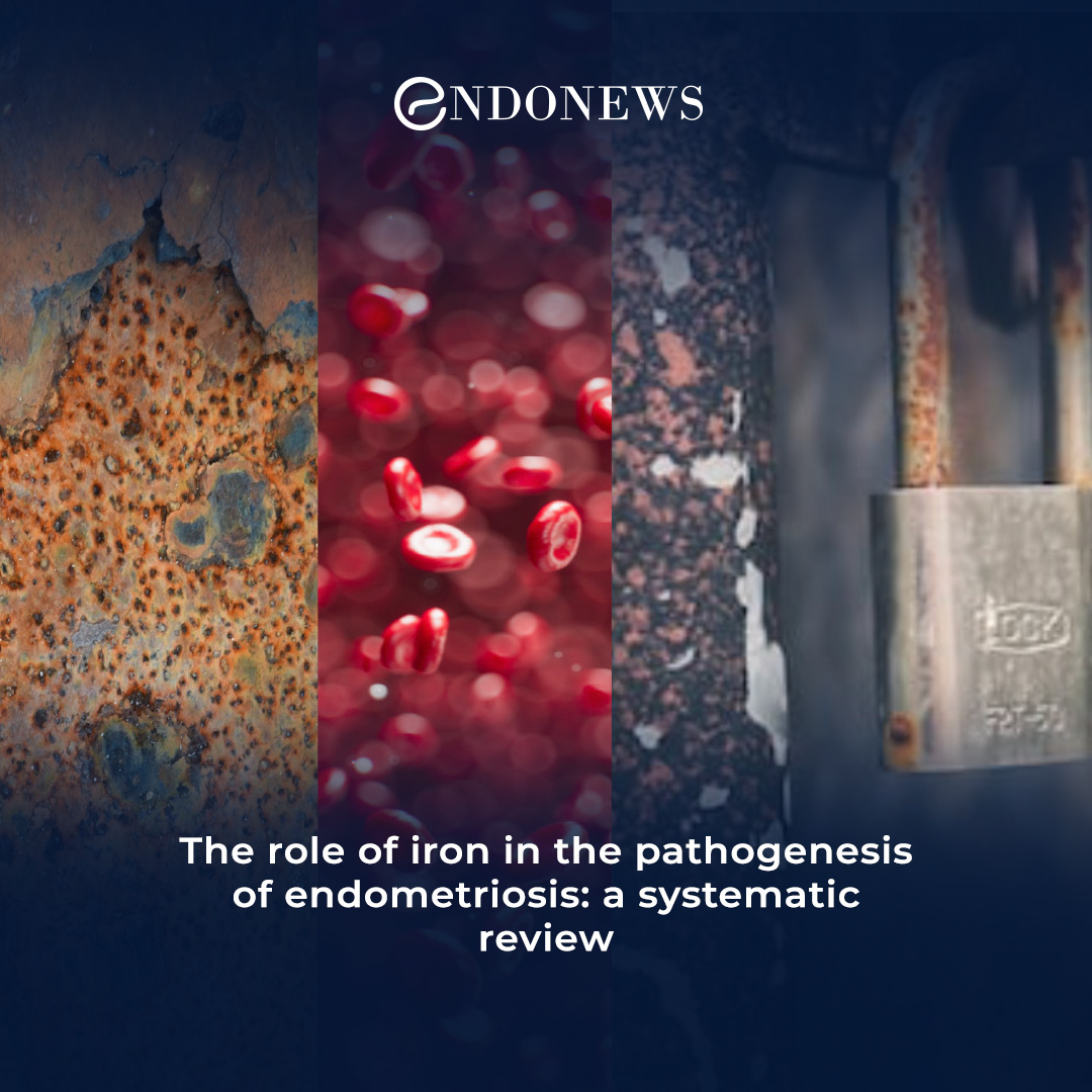 elevated-iron-levels-in-endometriosis-pathogenesis-endonews