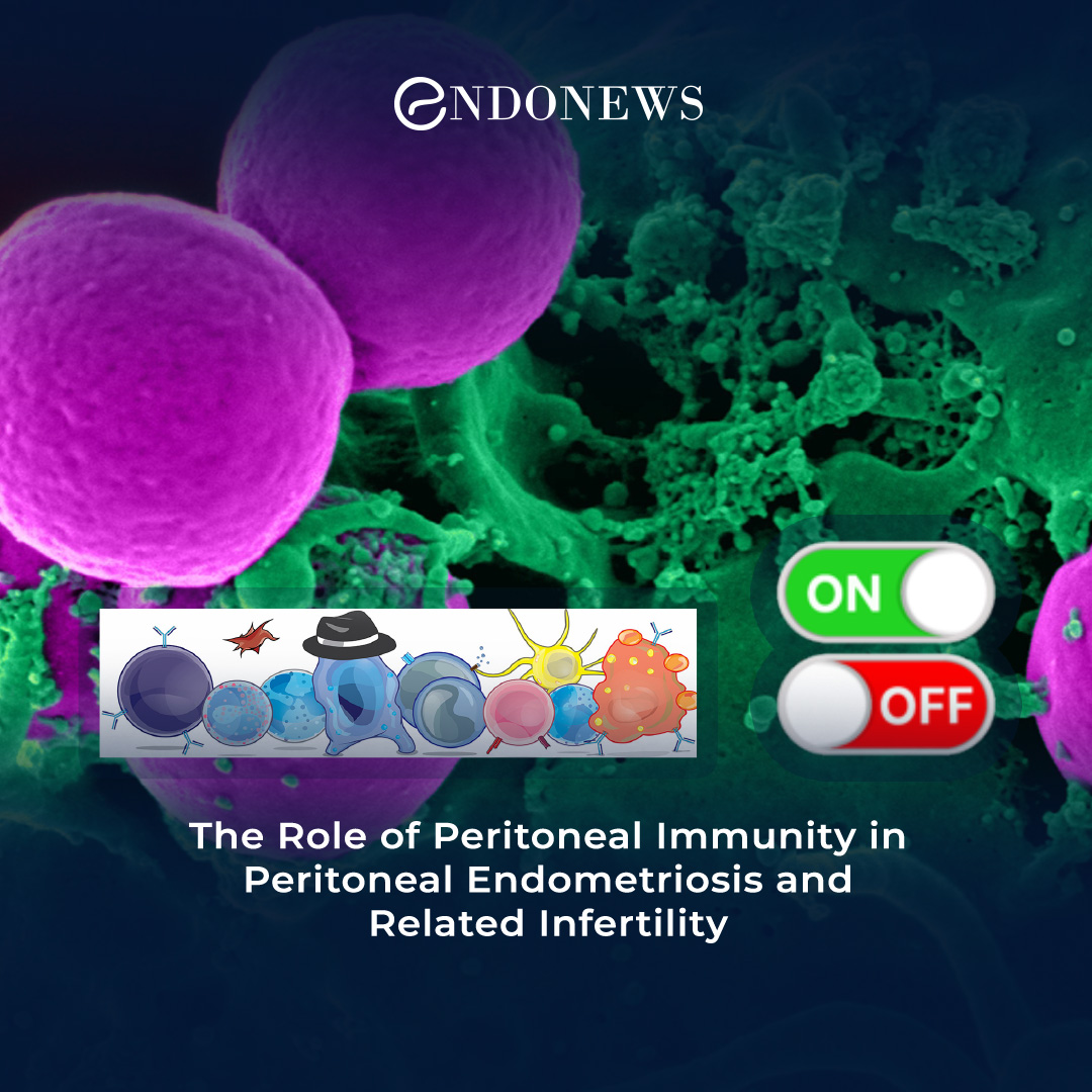 Peritoneal endometriosis and Peritoneal Immunity | EndoNews