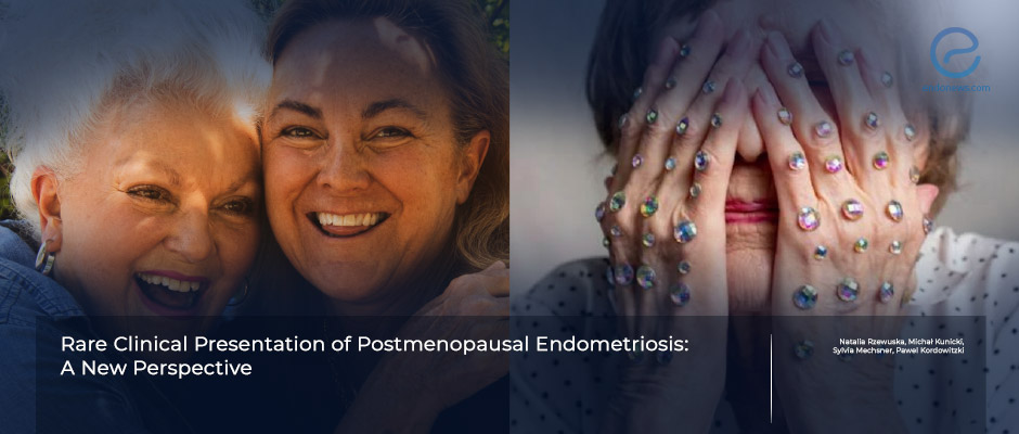 Post-menopausal bleeding  Women's Health by Dr Lee Say Fatt