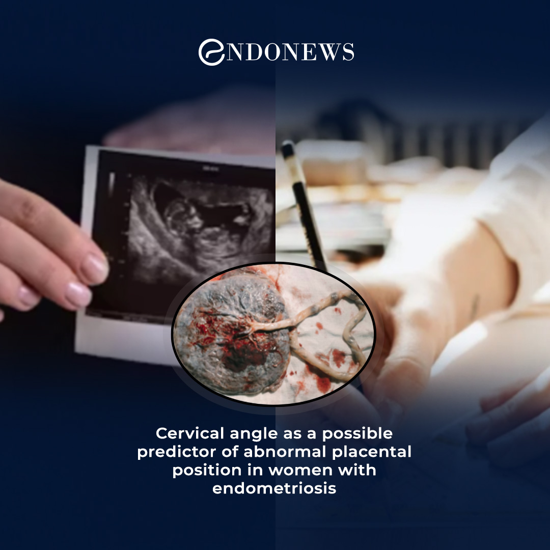 Cervical angle, retroflex uterus and abnormal placental position in ...