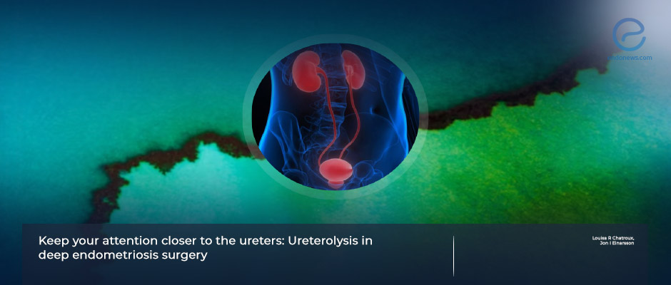Key Aspects of Ureterolysis in deep endometriosis surgery