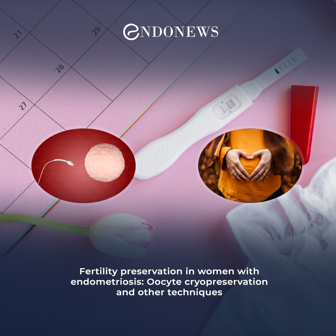 The need for fertility preservation in women with endometriosis | EndoNews