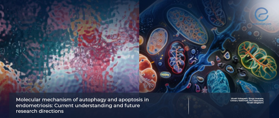 Cellular mechanisms in endometriosis revisited