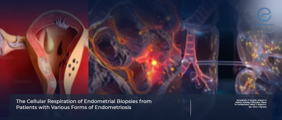 Mitochondrial Respiratory Chain in Endometriosis of Various Locations