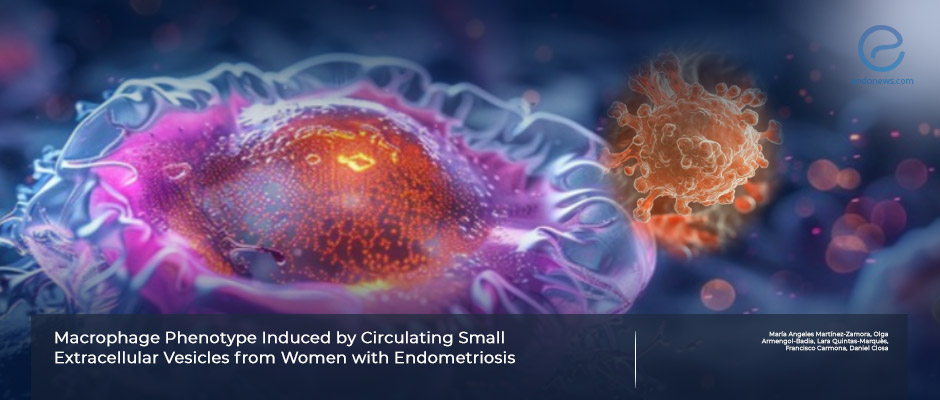 Macrophage Phenotypes Induced by Circulating Extracellular Vesicles in Endometriosis