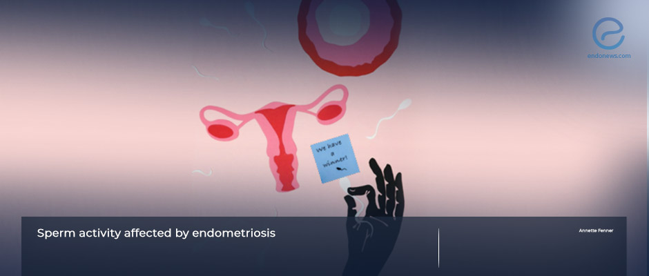 Does endometriosis have an adverse effect on sperm activity?  