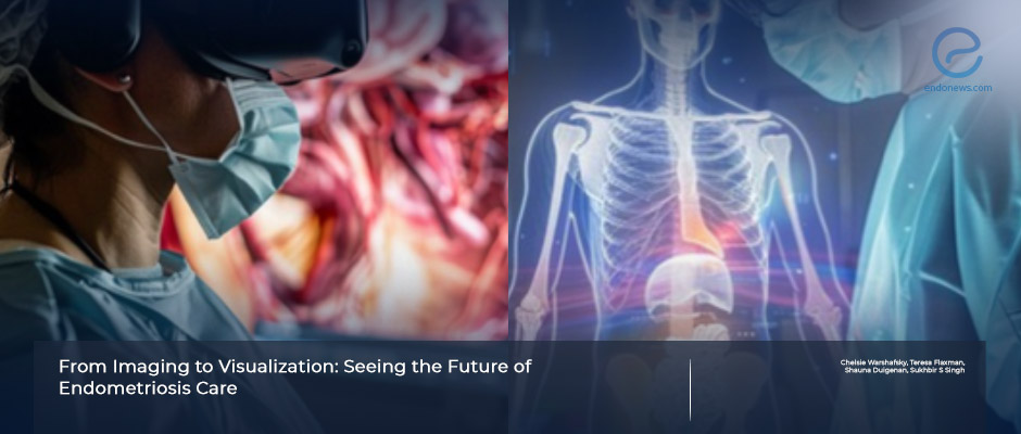 Integrating Virtual Reality Modeling for Enhanced Surgical Management of Endometriosis