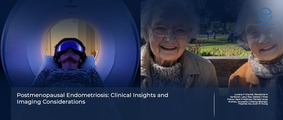 Imaging findings in postmenopausal endometriosis