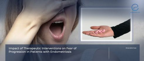 Fear of Progression in Endometriosis: The Role of Treatment Approach