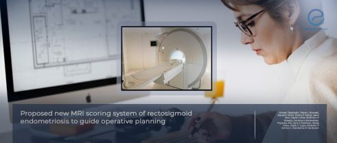 MRI-Based Scoring System Predicts Surgical Approach in Rectosigmoid Endometriosis