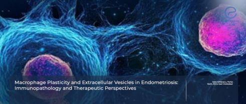 Endometriosis Immunopathology: The Macrophage Connection