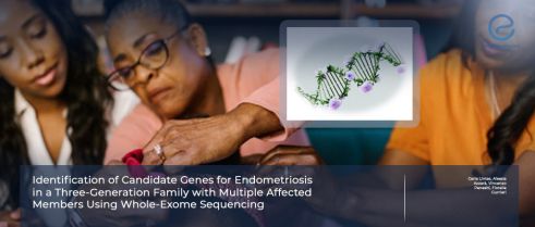 Study Points to Polygenic Etiology in Familial Endometriosis