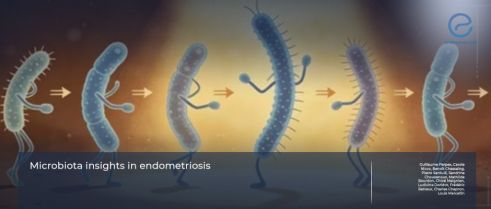 Microbiota Insights in Endometriosis