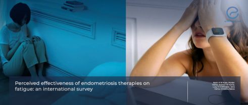Endometriosis Treatments Fall Short in Combating Fatigue