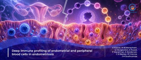 Novel immune cell alterations in the endometrium of women with endometriosis