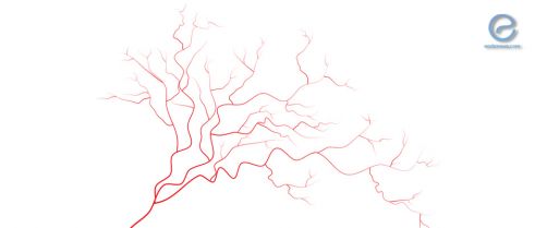 Reduced vascularization in ovarian endometriomas associated with less pain