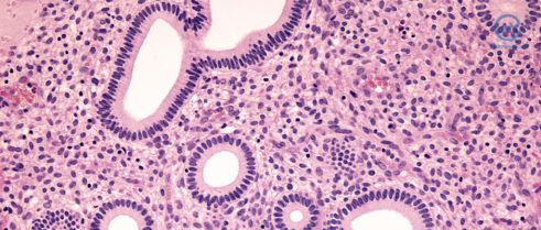 CCL19/CCR7 Interaction can Casue Characteristic Cell Proliferation