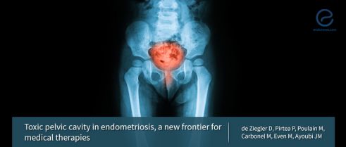 Toxic Pelvic Cavity and Infertility