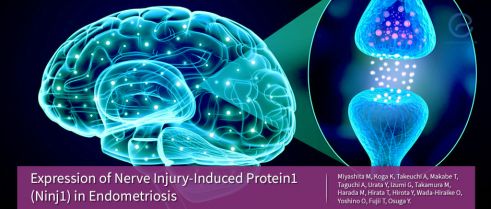 A novel neurotransmitter, Ninj1, has been found to be expressed in endometriosis