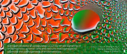 A newly found relationship between estrogen signalling and immune dysregulation in endometriosis