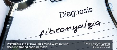 The coexistence deep infiltrating endometriosis and fibromyalgia