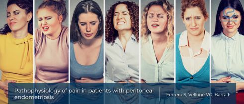 Pathophysiology of peritoneal endometriosis pain.