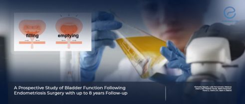  Bladder Function Alterations Following Endometriosis Surgery