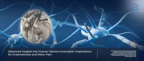  Uterine innervation and its impact on endometriosis related pelvic pain.