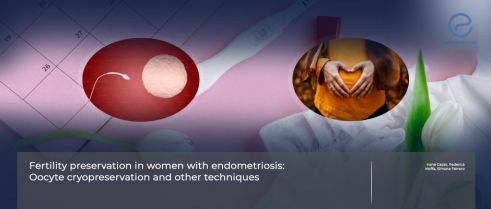 The need for fertility preservation in women with endometriosis