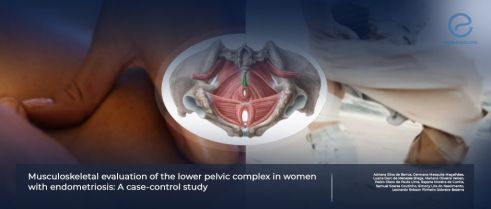 Endometriosis and musculoskeletal function of pelvic loin complex
