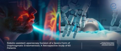  Robotic-assisted laparoscopy to manage severe diaphragmatic endometriosis 