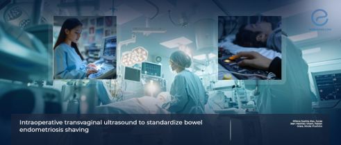 Intraoperative Transvaginal Ultrasound-Guided Resection of Bowel Endometriosis