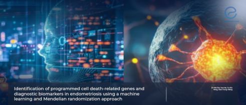 Study Sheds Light on the Role of Programmed Cell Death in Endometriosis